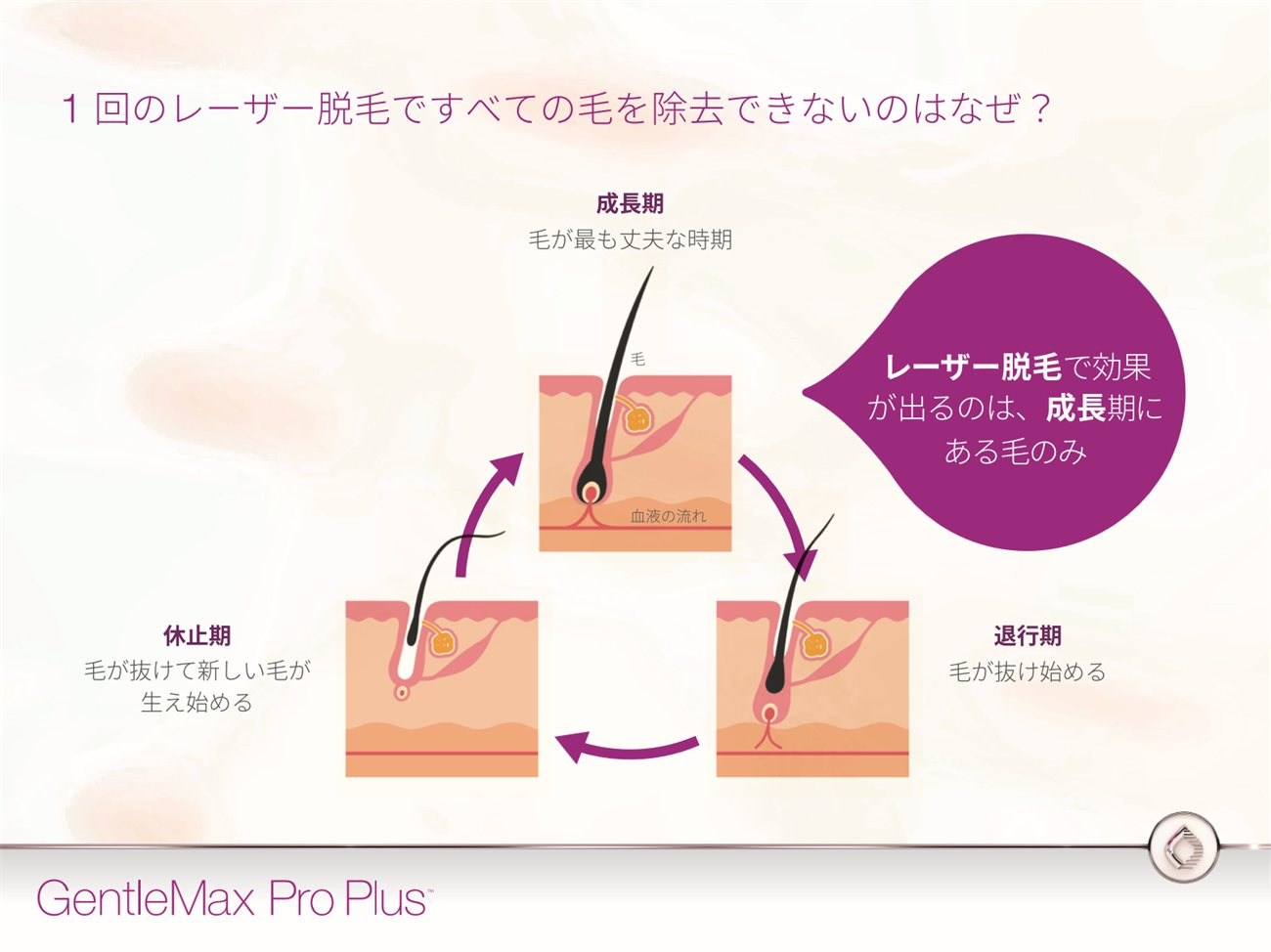 毛周期のサイクル図。成長期・退行期・休止期の3段階を示し、レーザー脱毛で効果が出るのは成長期にある毛のみであることを説明